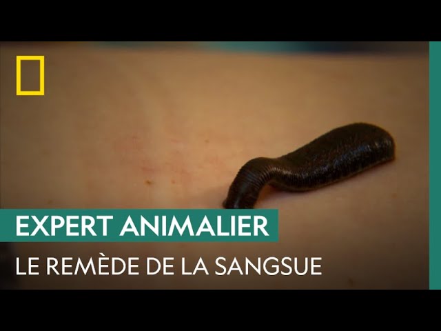 Les sangsues, remède universel